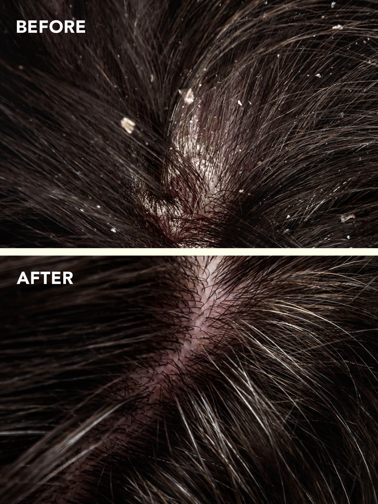 Dandruff & Itchy Scalp