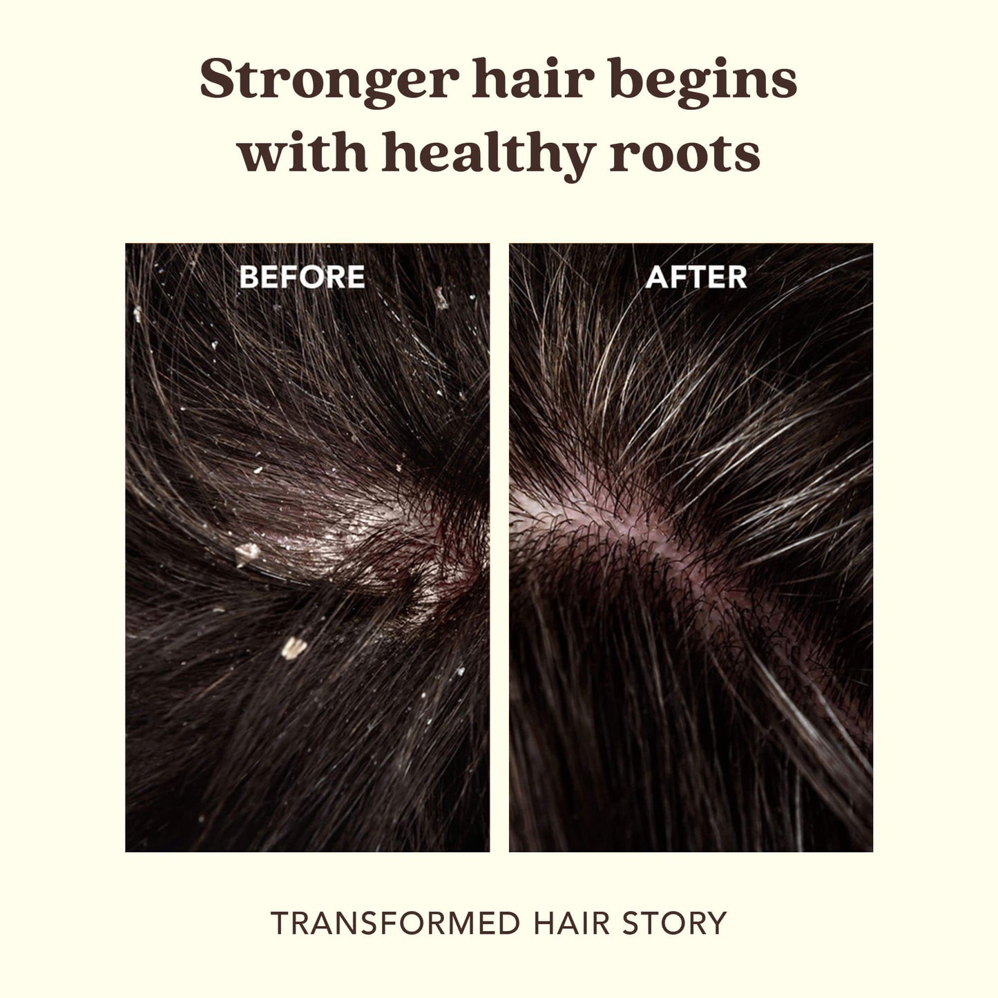 CALENDULA + HYALURONIC ACID Soothing Scalp Serum