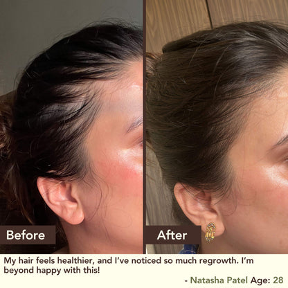 SHIKAKAI + BHRINGRAJ Hair Growth Scalp Serum For Women