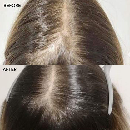 SHIKAKAI + BHRINGRAJ Stimulating Hair and Scalp Oil