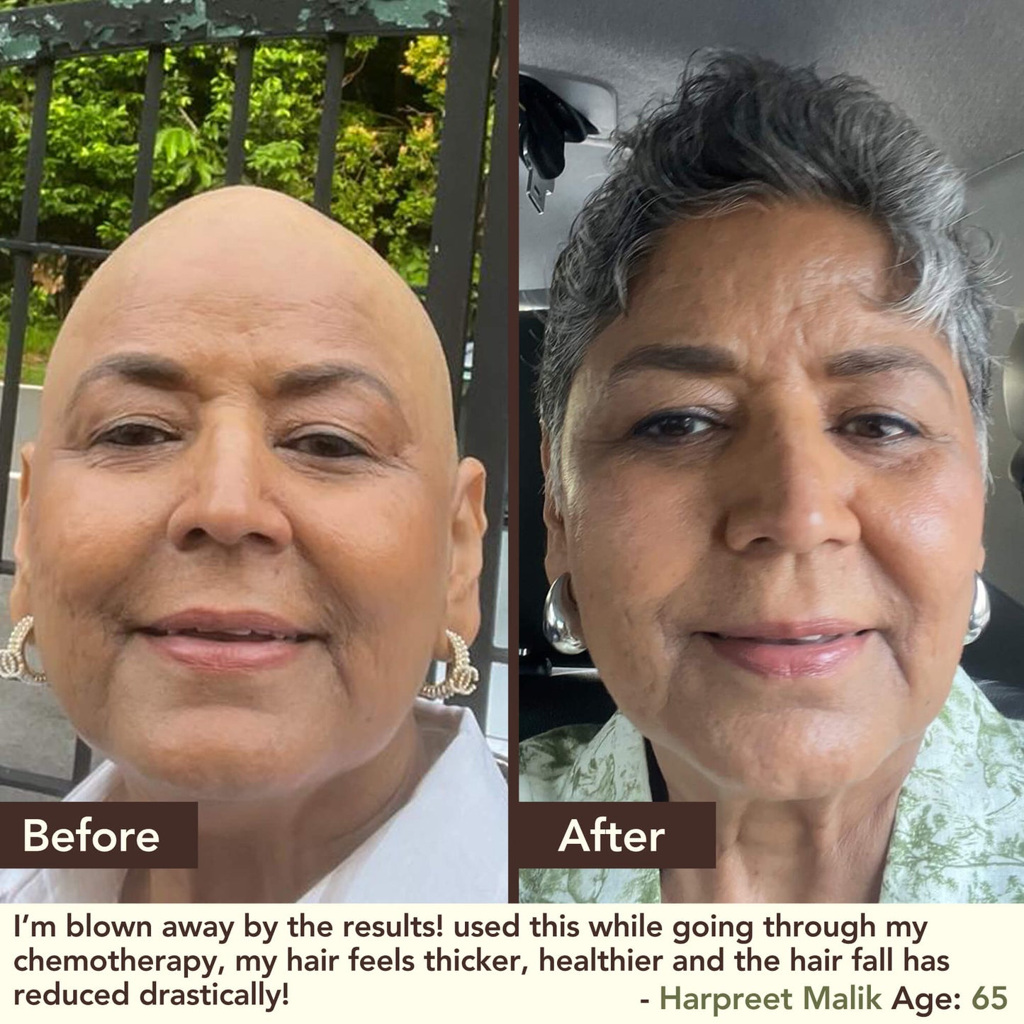 SHIKAKAI + BHRINGRAJ Hair Growth Scalp Serum