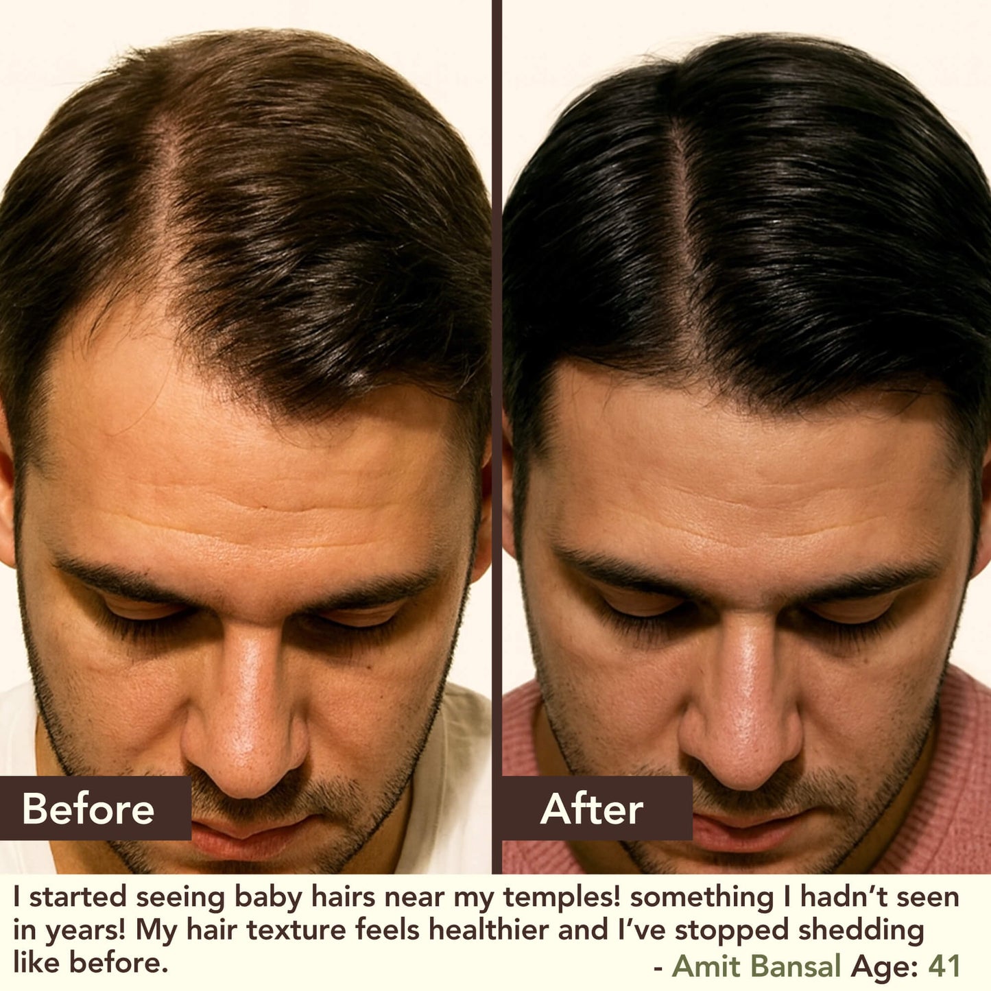 SHIKAKAI + BHRINGRAJ Hair Growth Scalp Serum