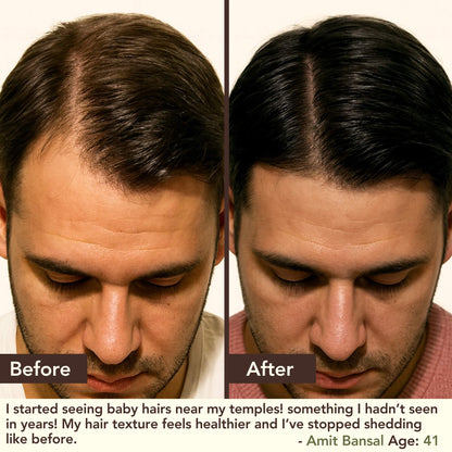 SHIKAKAI + BHRINGRAJ Hair Growth Scalp Serum