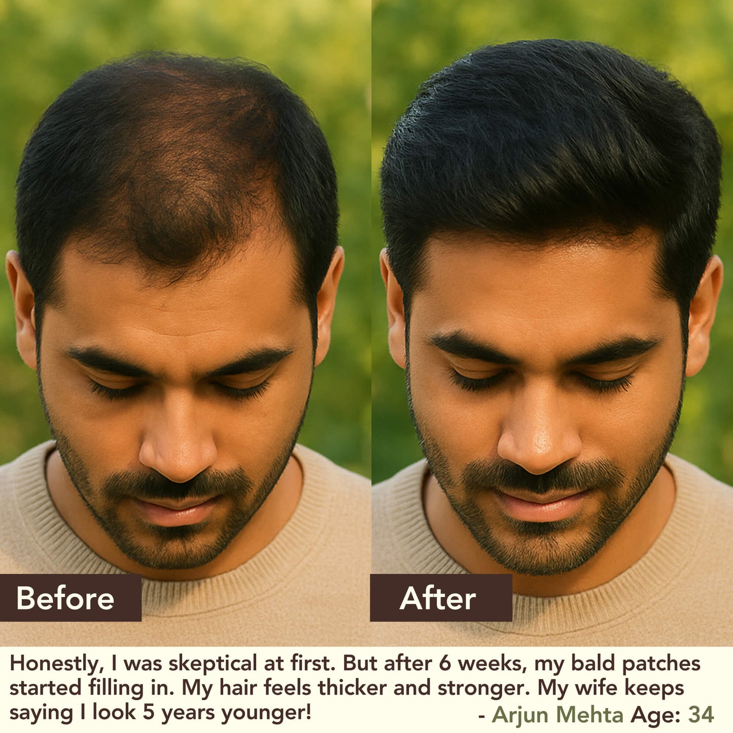 SHIKAKAI + BHRINGRAJ Hair Growth Scalp Serum For Men