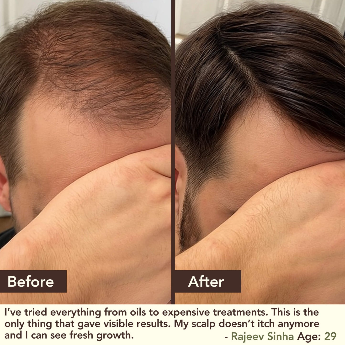 SHIKAKAI + BHRINGRAJ Hair Growth Scalp Serum