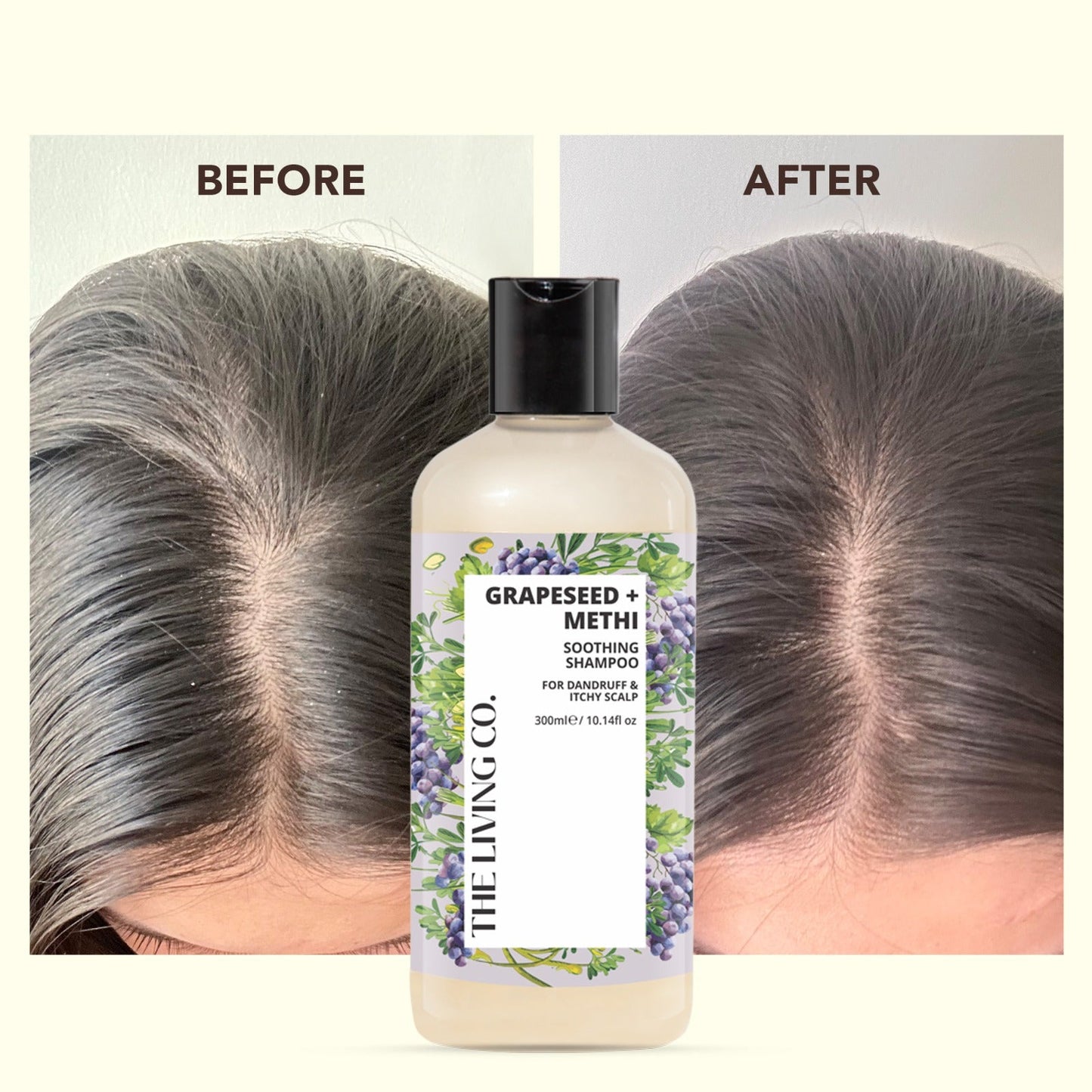 Clarifying Shampoo with GRAPESEED + METHI for Dandruff & Itchy Scalp