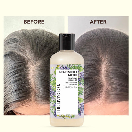 Clarifying Shampoo with GRAPESEED + METHI for Dandruff & Itchy Scalp