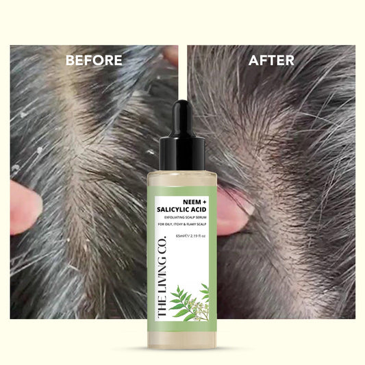 NEEM + SALICYLIC ACID Exfoliating Scalp Serum