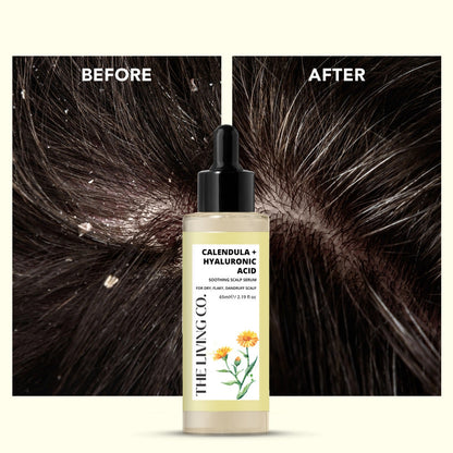 CALENDULA + HYALURONIC ACID Soothing Scalp Serum