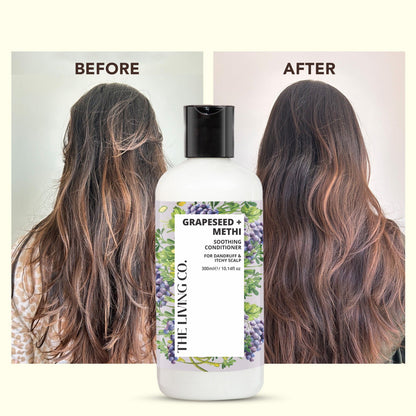Clarifying Conditioner with GRAPESEED + METHI for Dandruff & Itchy Scalp - 300ml