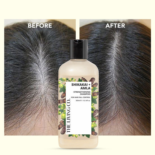 Strengthening Shampoo with SHIKAKAI + AMLA for Hair Fall Control