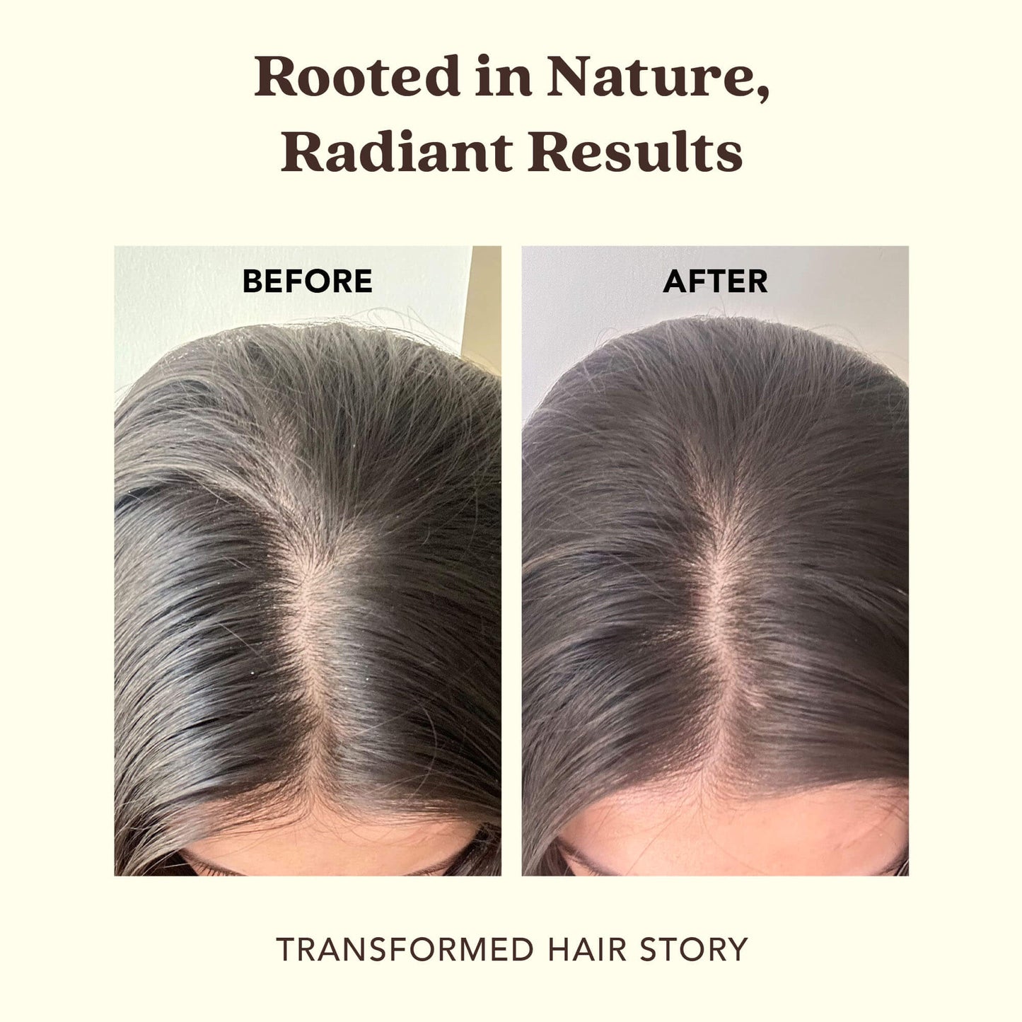 Clarifying Shampoo with GRAPESEED + METHI for Dandruff & Itchy Scalp