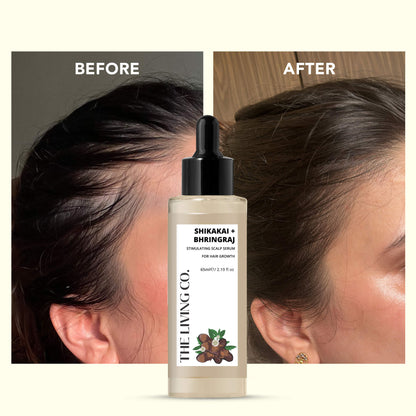 SHIKAKAI + BHRINGRAJ Hair Growth Scalp Serum