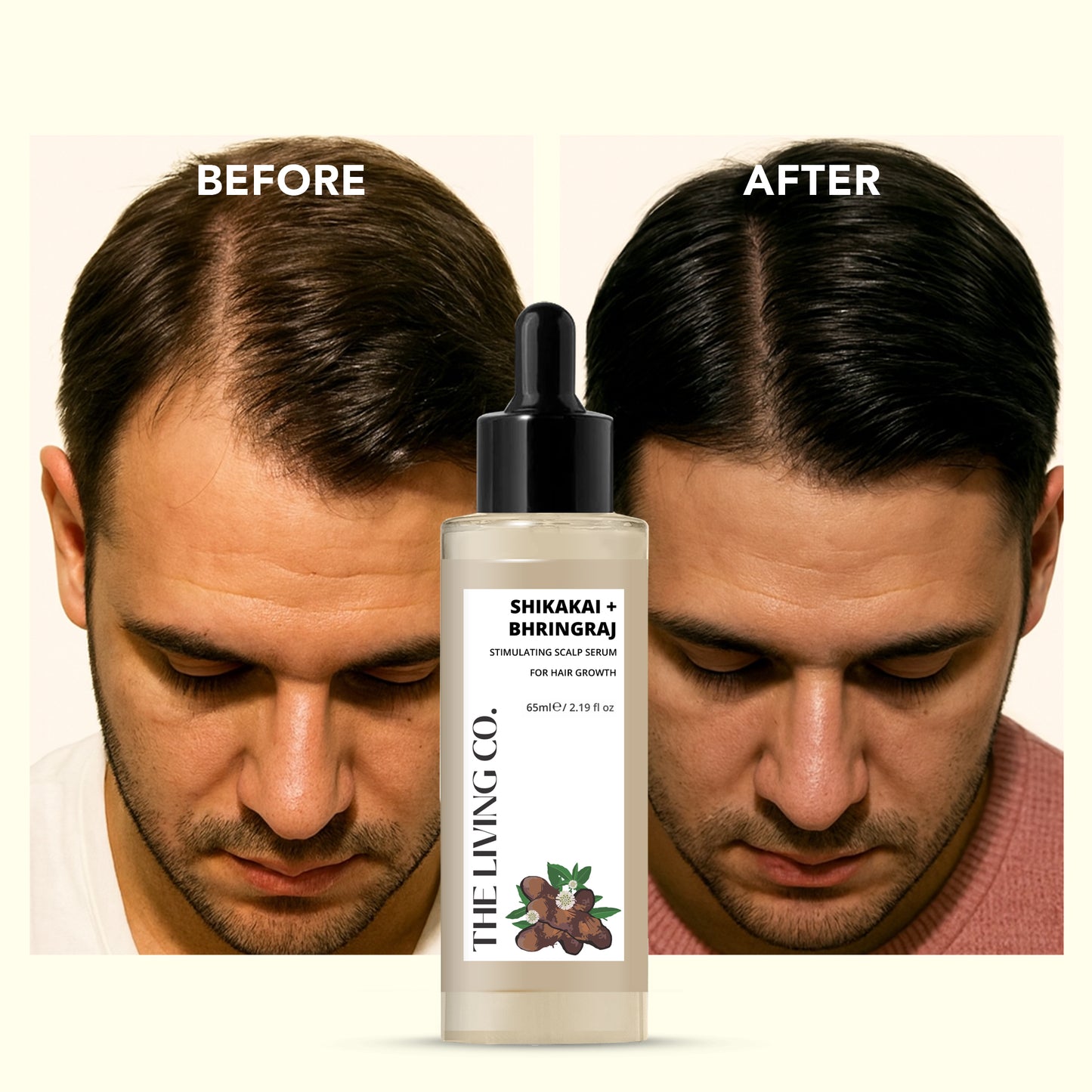 SHIKAKAI + BHRINGRAJ Hair Growth Scalp Serum For Men