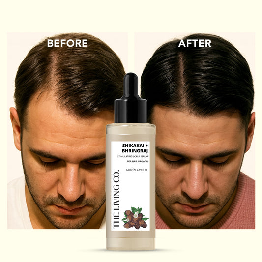 SHIKAKAI + BHRINGRAJ Hair Growth Scalp Serum For Men